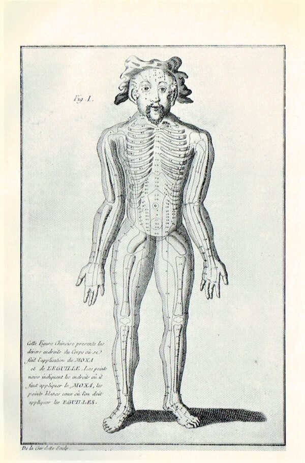 L'Acupuncture Chinoise (Thérapeutique Energétique)